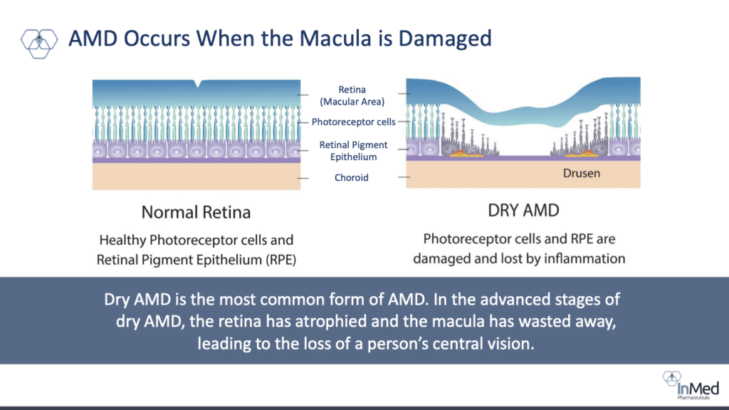 InMed Pharmaceutical
